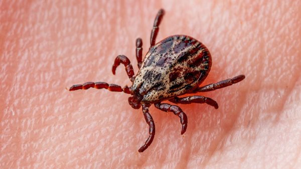 Once-rare infection spread by tick bites has reached the UK