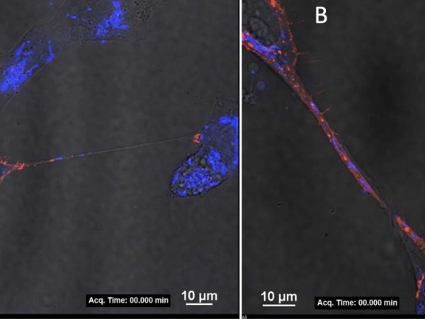 How does Zika virus replicate and transmit from mother to fetus? | Penn State University