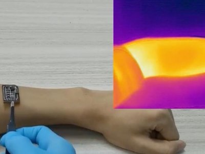 Improved, self-healing medical sensor responds to temperature, adapts to skin | Penn State University