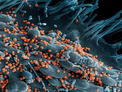 Penn State research team will study Lassa virus spread in Nigeria | Penn State University