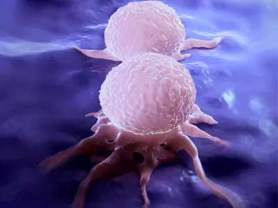 Potentially Revolutionizing Cancer Treatment – Scientists Uncover Mechanics of Breast Cancer Metastasis